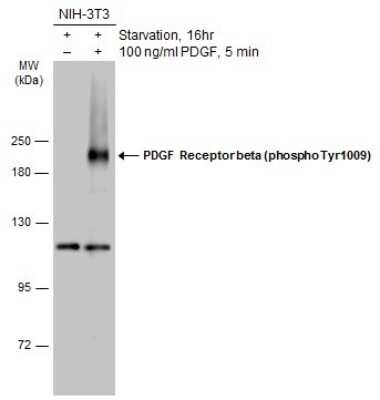 Western Blot: PDGF R beta [p Tyr1009] Antibody [NBP3-13237]